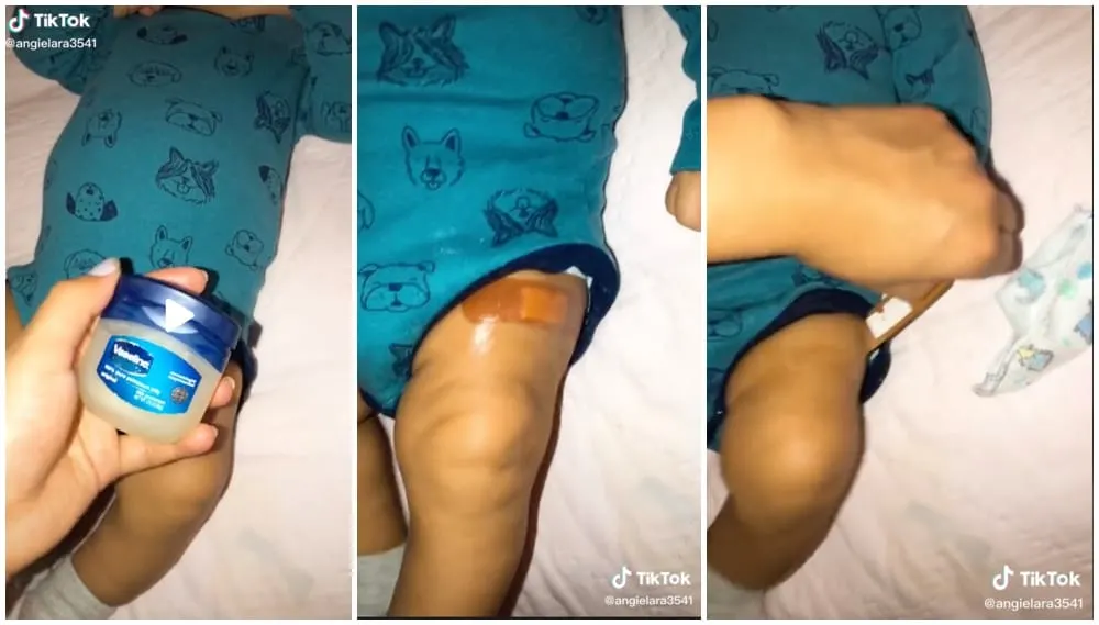 Easy Hack For Removing Bandage Painlessly